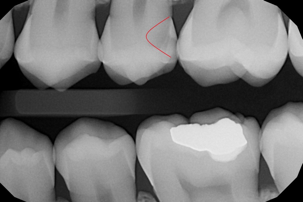 Vstupní vyšetření